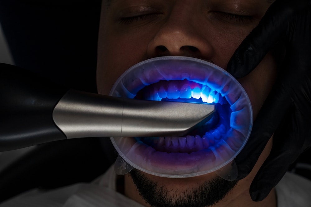 Advanced Technology in Bishop, CA. Dr. Brian L. Carkeet. Carkeet Dental